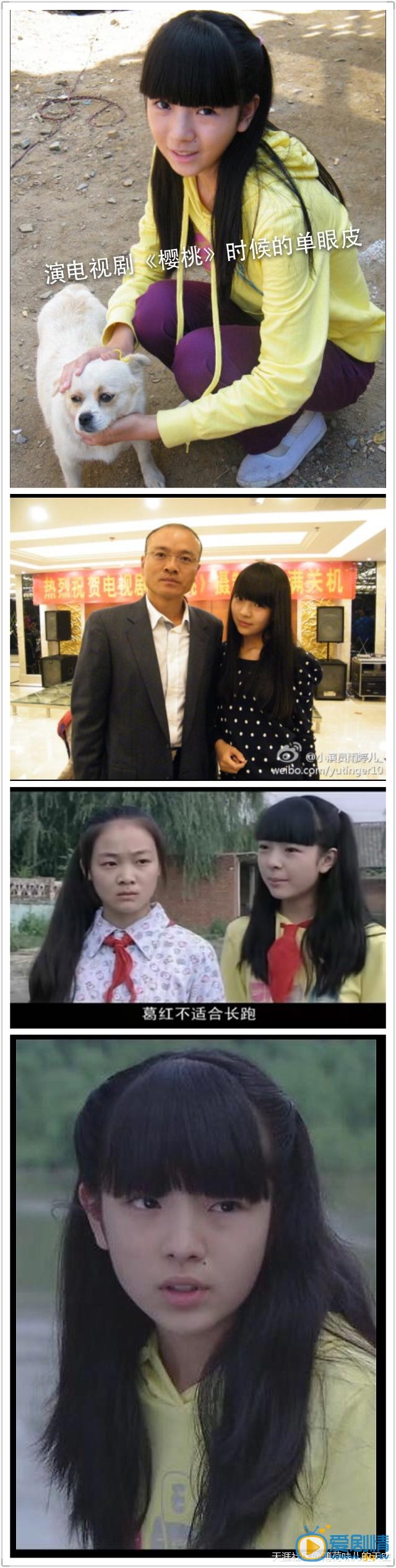 雨婷儿整容了吗？雨婷儿整容前后照片对比 雨婷儿整容前照片